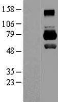 Human MID1 Protein (Over-Expression Lysate Myc-DDK (Flag))
