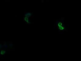 APCS / Serum Amyloid P / SAP Antibody (clone OTI5A9)