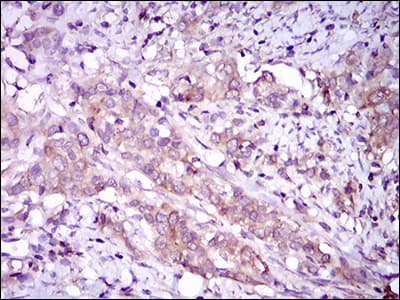Monoclonal Mouse anti-Human MAPK14 / p38 Antibody (clone 8G4D11, aa299-360, IHC, IF, WB)