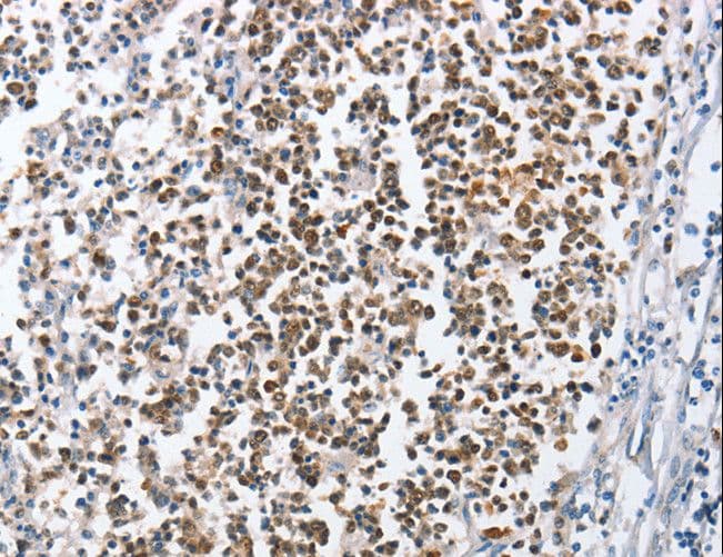 Polyclonal Rabbit anti-Human MCM6 Antibody (IHC, WB)