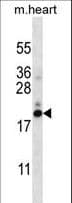 PFDN5 / MM1 Antibody (aa79-108)
