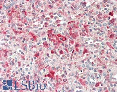 IHC-plus™ Polyclonal Rabbit anti-Human PIK3CD / PI3K Delta Antibody (IHC, WB)