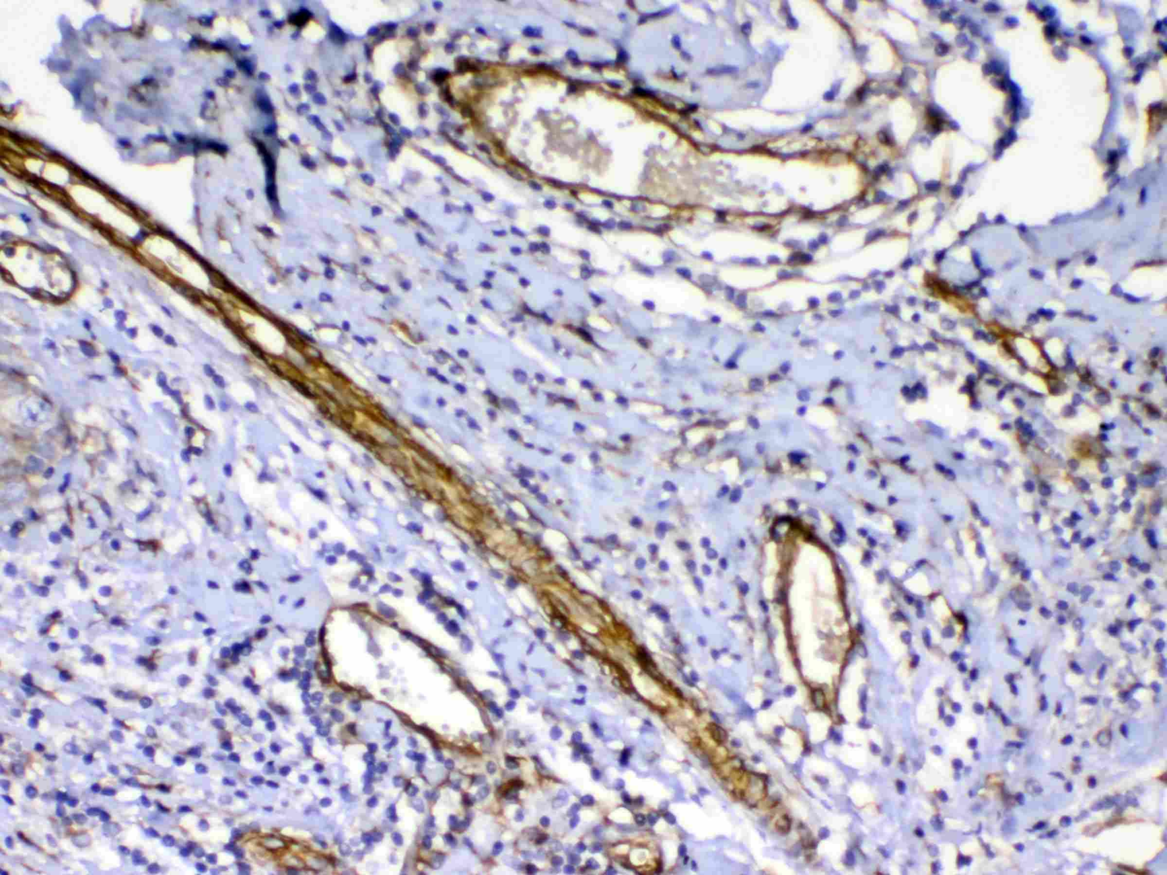 Polyclonal Rabbit anti-Human FLT4 / VEGFR3 Antibody (IHC, WB)