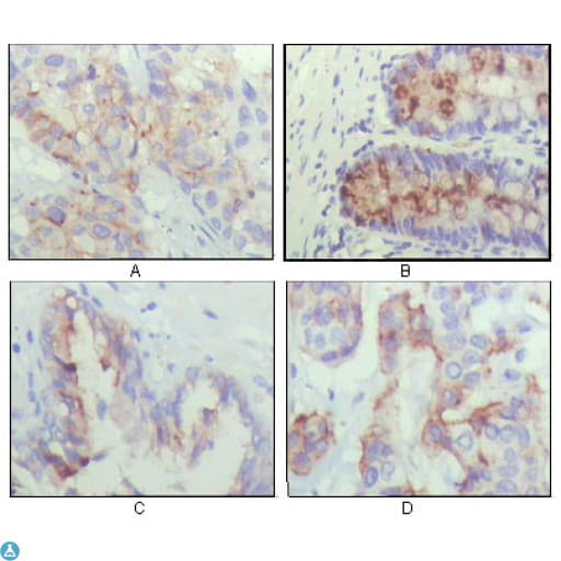 IGFBP2 / IGF-BP53 Antibody