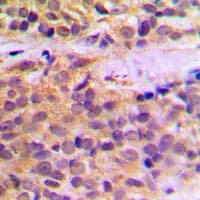 Polyclonal Rabbit anti-Human RAB11FIP1 Antibody (aa109-148, IHC, WB)
