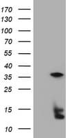 Monoclonal Mouse anti-Human TS / Thymidylate Synthase Antibody (clone OTI1B1, IHC, WB)