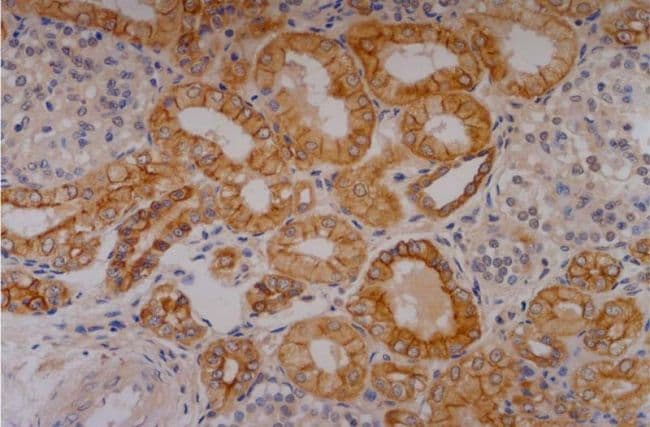 KRT18 / CK18 / Cytokeratin 18 Antibody (clone C-04)