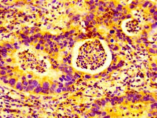 GP78 / AMFR Antibody