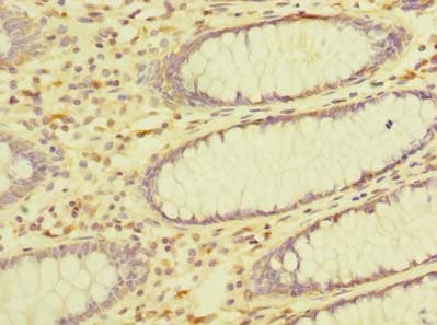 Polyclonal Rabbit anti-Human ZDHHC23 Antibody (IHC, WB)