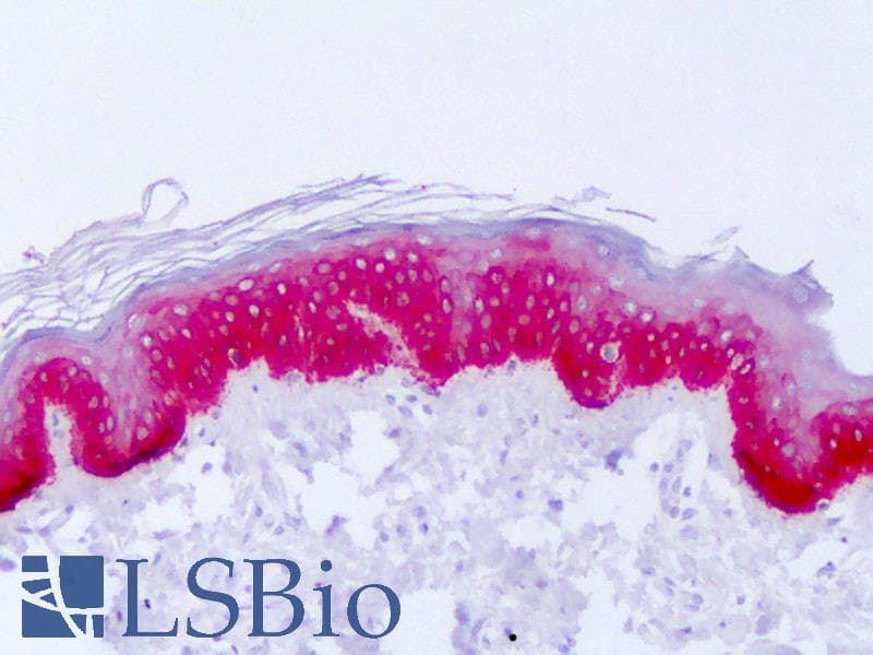 KRT14 / CK14 / Cytokeratin 14 Antibody (C-Terminus)