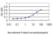 IHC-plus™ Monoclonal Mouse anti-Human MPS1 / TTK Antibody (clone 3G7, IHC, WB)