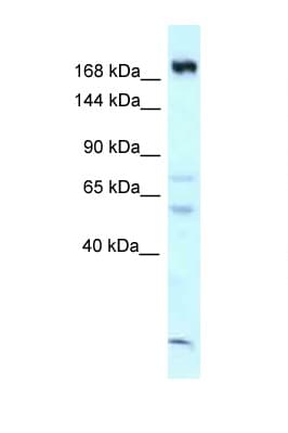 Polyclonal Rabbit anti-Mouse CAMSAP1 Antibody (aa1290-1339, WB)