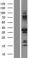 Human PPIE / Cyclophilin E Protein (Over-Expression Lysate Myc-DDK (Flag))