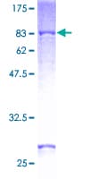 Human OXCT1 Protein (Recombinant GST)