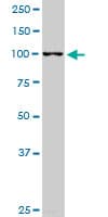 RABGAP1L Antibody (clone 2D3)