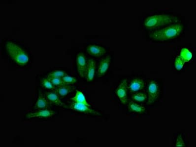 Polyclonal Rabbit anti-Human FARSB Antibody (IF, WB)