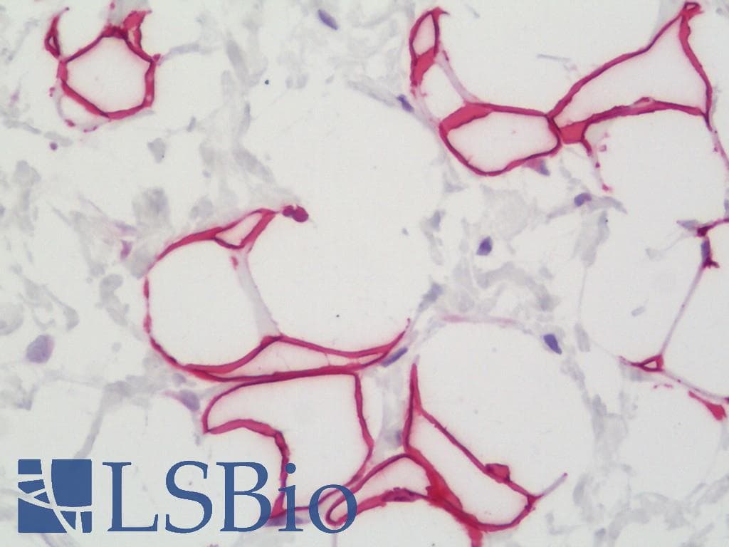 IHC-plus™ Polyclonal Rabbit anti-Human SLC7A5 / CD98 Light Chain Antibody (IHC, WB)