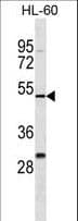 ZNF187 Antibody (aa3-31)