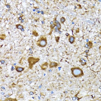 MAP1LC3A / LC3A Antibody