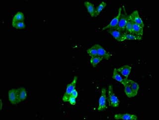 RENT1 / UPF1 Antibody