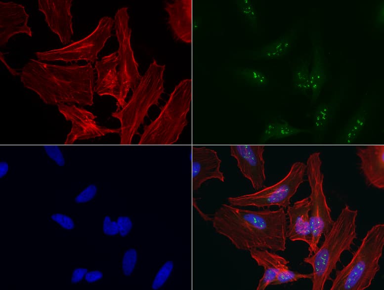 Monoclonal Mouse anti-Human TP53 / p53 Antibody (clone UMAB206, Carrier-free, IHC, IF, WB)