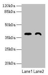 FAM70A Antibody