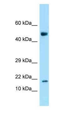 Polyclonal Rabbit anti-Mouse ANKRD37 Antibody (aa46-95, WB)