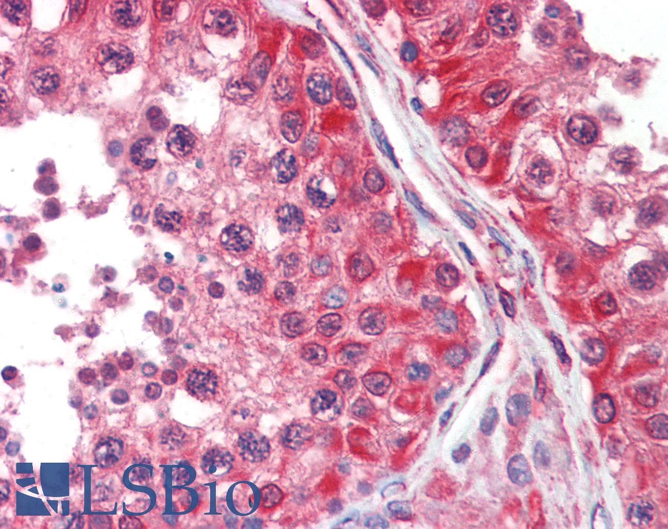 IHC-plus™ Monoclonal Mouse anti-Human DPYSL2 / CRMP2 Antibody (clone 33CT11.40.3, aa463-492, IHC, WB)