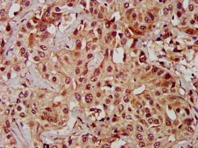 Polyclonal Rabbit anti-Human MAPK1 / ERK2 Antibody (IHC, IF, WB)