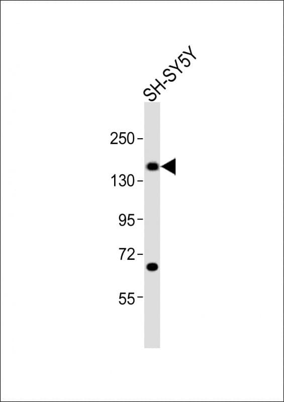 CTCF Antibody (aa185-216)
