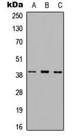 MTNR1A / Melatonin Receptor 1a Antibody (Internal)