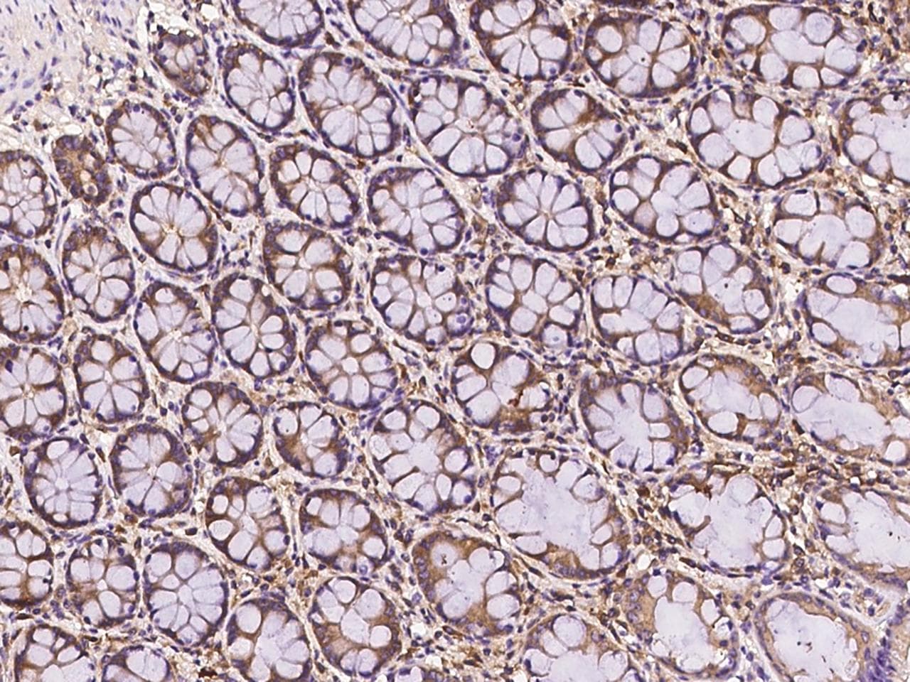 FAM200A Antibody