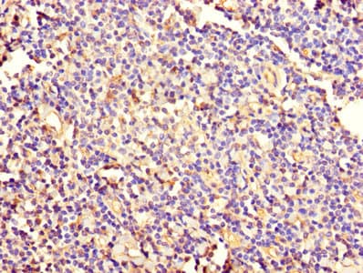 Polyclonal Rabbit anti-Human KRT4 / CK4 / Cytokeratin 4 Antibody (WB)