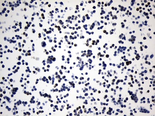 VIL1 / Villin Antibody (aa1-188, clone UMAB230)