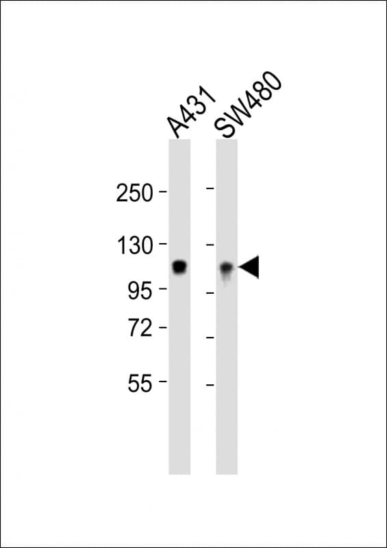 ITGA7 / Integrin Alpha 7 Antibody (aa1149-1181)