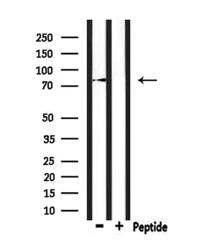 LRSAM1 Antibody