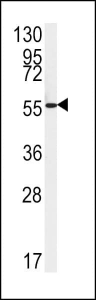FAAH2 Antibody (aa409-438)
