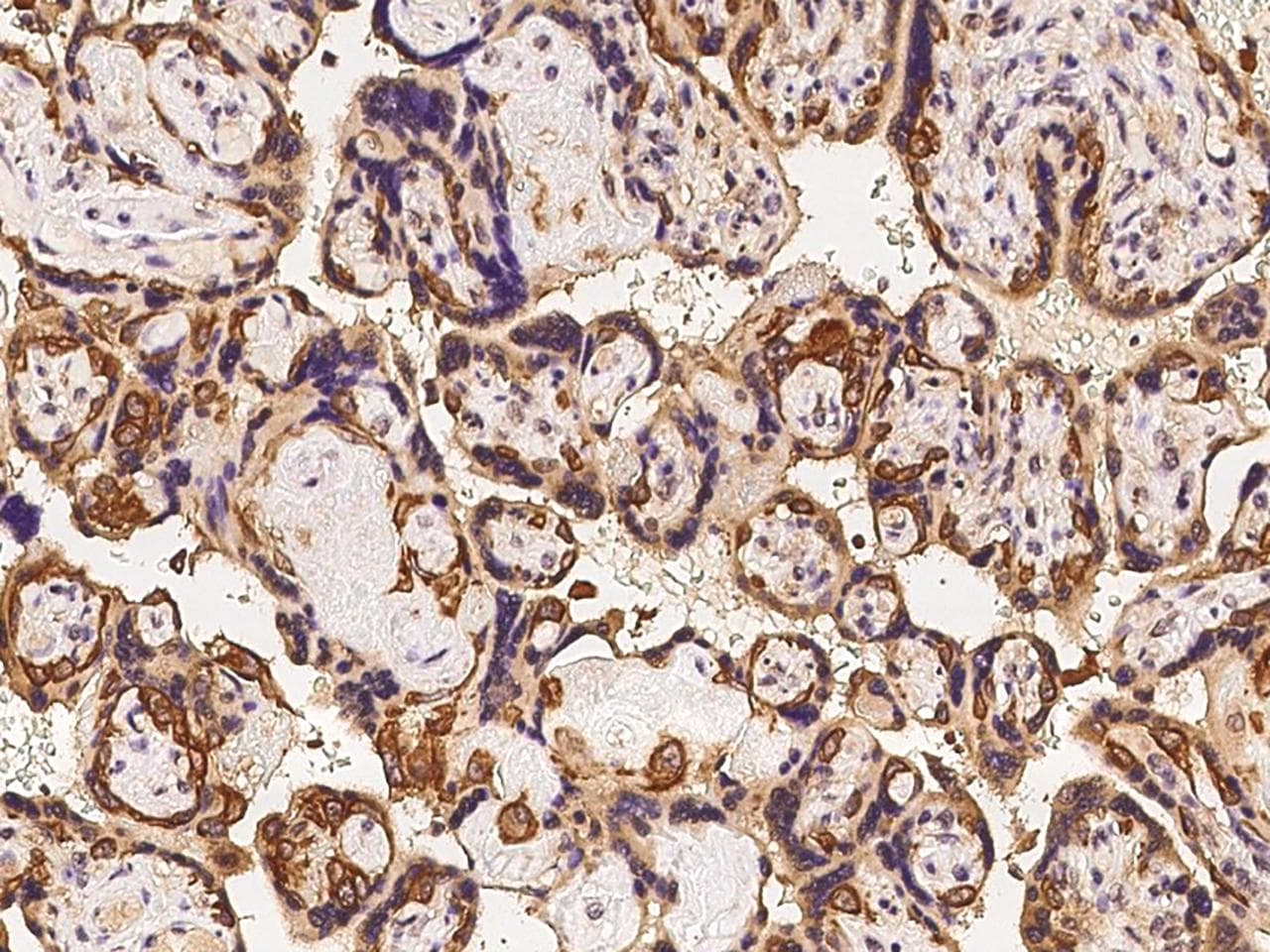 Polyclonal Rabbit anti-Human PODNL1 Antibody (IHC)