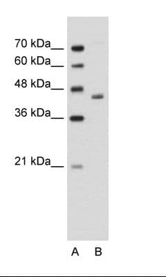 ADH2 / ADH1B Antibody (aa301-350)