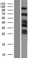 SH3KBP1 / CIN85 Protein (Over-Expression Lysate Myc-DDK (Flag))