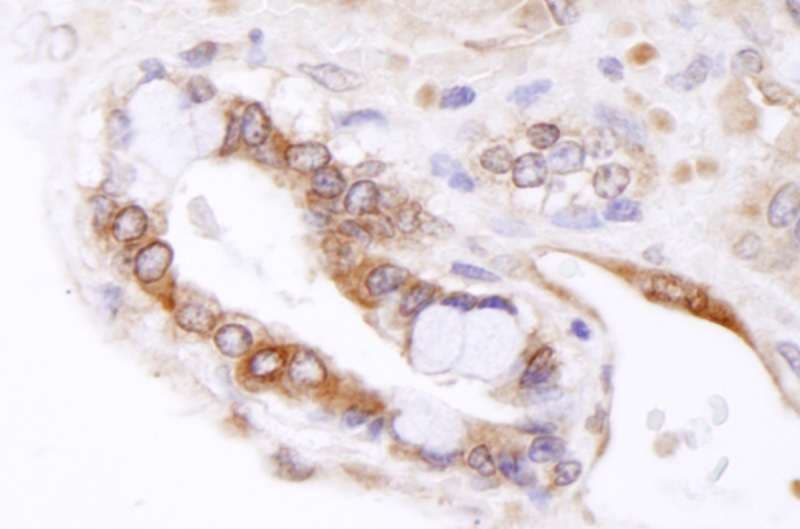 Polyclonal Rabbit anti-Human ABCB9 Antibody (aa475-525, IHC, IF)