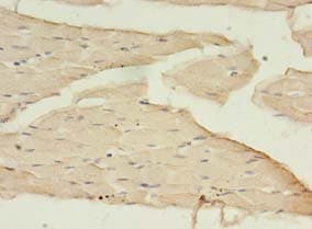 Polyclonal Rabbit anti-Human BDNF Antibody (IHC)