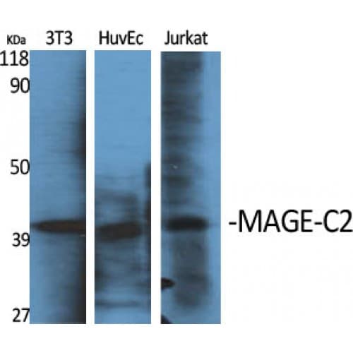 MAGEC2 / CT10 Antibody (160-240 aa, Internal)
