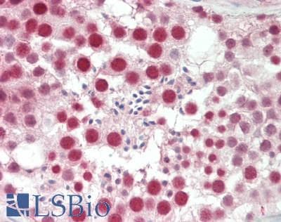 ZMYM2 / RAMP Antibody (aa1327-1377)