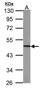 IHC-plus™ FH / Fumarase / MCL Antibody (aa89-365)
