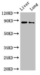 Polyclonal Rabbit anti-Human DENND1C Antibody (IHC, WB)