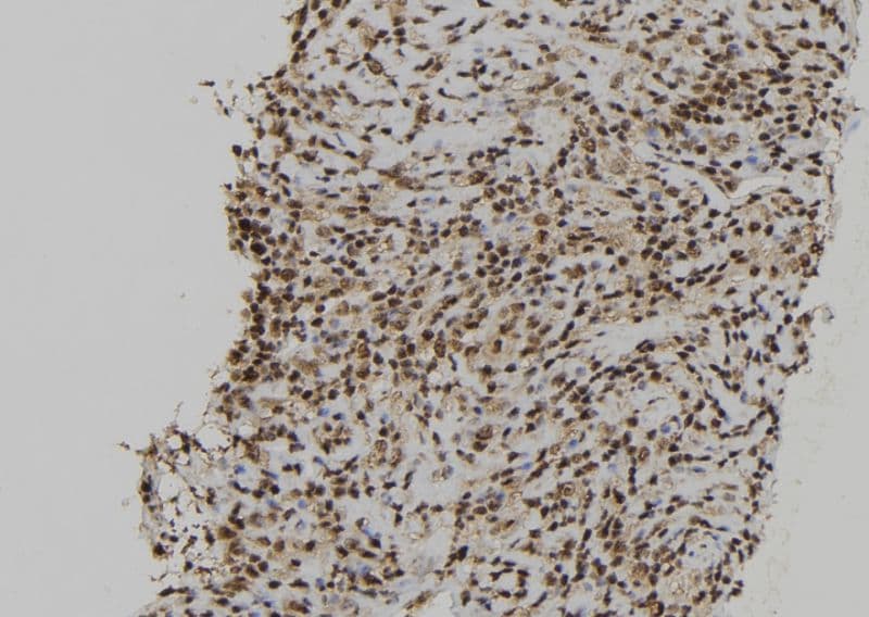 RCC2 Antibody