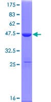 Human p21-ARC / ARPC3 Protein (Recombinant GST)