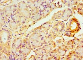ABCB2 / TAP1 Antibody (aa524-808)