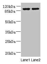 Polyclonal Rabbit anti-Human EFHB Antibody (WB)